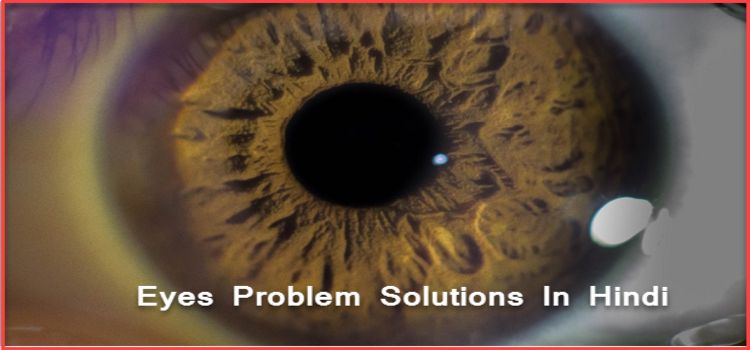 Eye Problem Solution In Hindi, आँखों की बीमारियों का इलाज