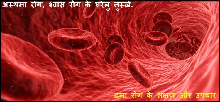 अस्थमा रोग, दमा रोग, श्वास रोग का इलाज ! Dama Ka Ilaj अस्थमा रोग, दमा रोग, श्वास रोग का इलाज ! Dama Ka Ilaj